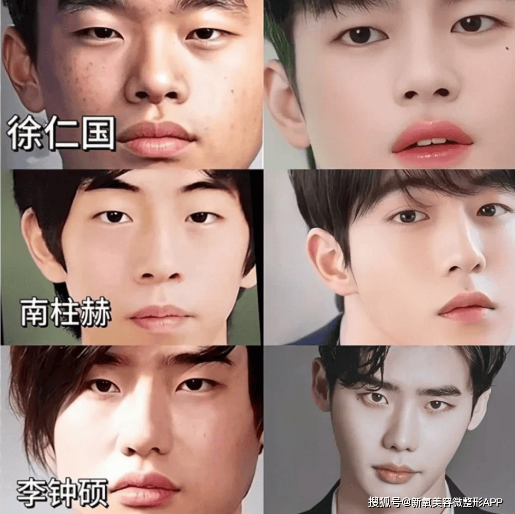 韩国男人往肩部埋双开门硅胶，20w人民币打成偏瘫？