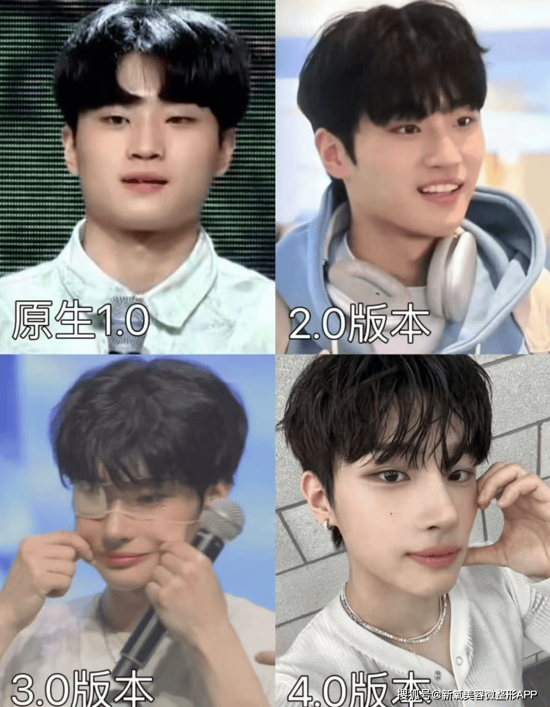 韩国男人往肩部埋双开门硅胶，20w人民币打成偏瘫？