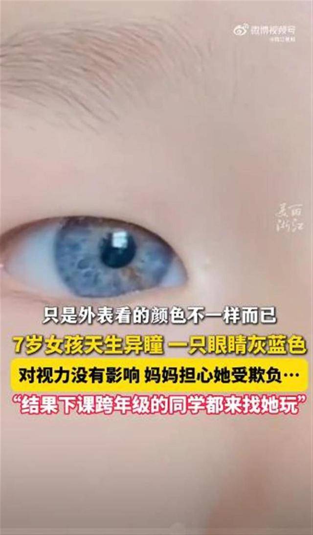 江西7岁女孩天生异瞳受到同学喜爱,医生:出现这些情况应及时治疗