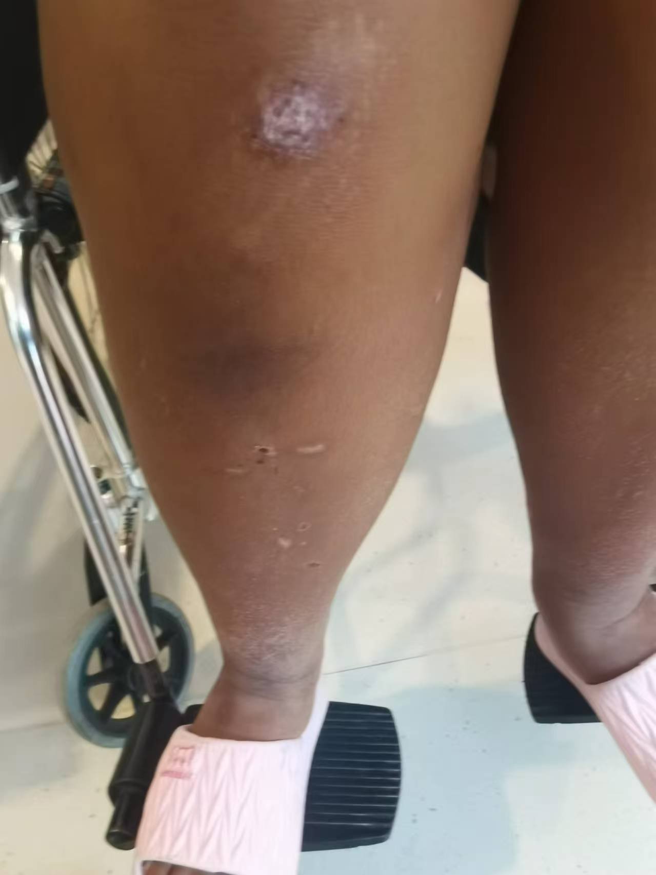 河南中牟14岁女孩拓展营身亡前遭体罚,“班主任”扣留求救信案将再次开庭,家属发声