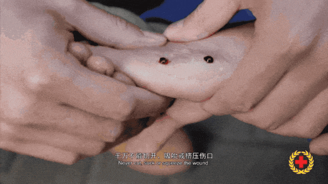 女子半夜上厕所，马桶里突然窜出一条蛇！